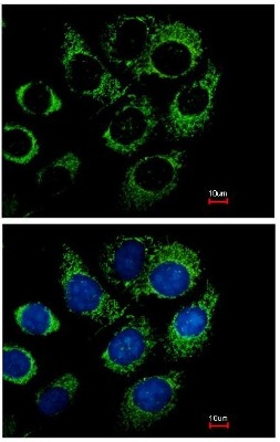 Immunofluorescence analysis of methanol fixed H1299 cells, labeling RBP1 using ab154881 at 1/500 dilution. Lower image costained with Hoerchst 33342.