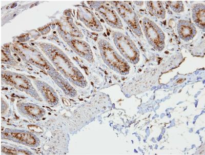 Immunohistochemical analysis of paraffin embedded Human colon tissue, labeling RBP1 using ab154881 at 1/100 dilution.