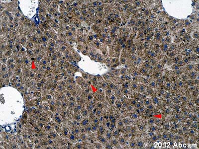 ab104452 staining mouse liver sections by IHC-P. The tissue was fixed with formaldehyde and a heat mediated antigen retrival step was performed with citric acid pH 6. Blocking of the sample was done with 1% BSA for 10 minutes at 21°C, followed by staining with ab104452 at 1/100 in TBS/BSA/azide for 2h at 21°C. A biotinylated rabbit anti-goat polyclonal antibody at 1/250 was used as the secondary antibody. Red arrowheads indicate strongly stained Kupffer cells.See Abreview