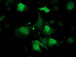 ab119056, at 1/100 dilution, staining RBP1 in COS7 cells transiently transfected with pCMV6-ENTRY RBP1 by Immunofluorescence.
