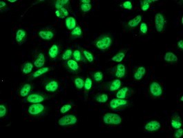 ab119056, at 1/100 dilution, staining RBP1 in Hela cells by Immunofluorescence.