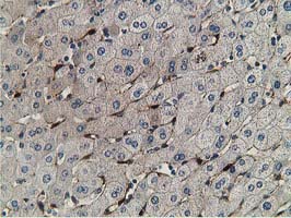 ab119056, at 1/150 dilution, staining RBP1 in paraffin-embedded Human liver tissue by Immunohistochemistry.
