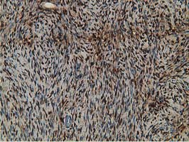 ab119056, at 1/150 dilution, staining RBP1 in paraffin-embedded Human ovary tissue by Immunohistochemistry.