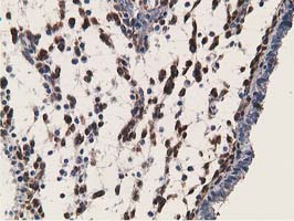 ab119056, at 1/150 dilution, staining RBP1 in paraffin-embedded Human endometrium tissue by Immunohistochemistry.