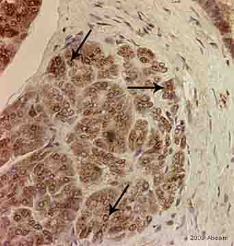 ab33065 staining RBPJK in human pancreatic tissue section by Immunohistochemistry (Formalin/PFA-fixed paraffin-embedded sections). Tissue underwent fixation in formaldehyde, heat mediated antigen retrieval in Citrate buffer pH 6.0 and blocking (5 minutes/peroxidase block then 10 minutes/protein block) for 15 minutes at 20°C. The primary antibody was diluted, 1/250 and incubated with sample for 45 minutes at 20°C. A HRP conjugated goat polyclonal to rabbit IgG was used undiluted as secondary.See Abreview