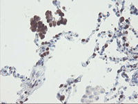 ab128081 at 1/150 dilution staining RBPMS in Paraffin-embedded Human lung tissue by Immunohistochemistry.