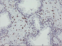 ab128081 at 1/150 dilution staining RBPMS in Paraffin-embedded Human prostate tissue by Immunohistochemistry.