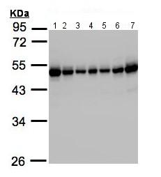 All lanes : Anti-RCC1 antibody (ab152156) at 1/1000 dilutionLane 1 : 293T whole cell lysateLane 2 : A431 whole cell lysateLane 3 : H1299 whole cell lysateLane 4 : HeLa S3 whole cell lysateLane 5 : HepG2 whole cell lysateLane 6 : MOLT4 whole cell lysateLane 7 : Raji whole cell lysateLysates/proteins at 30 µg per lane.