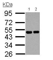 All lanes : Anti-RCC1 antibody (ab152156) at 1/1000 dilutionLane 1 : Neuro2A whole cell lysate/extractLane 2 : GL261 whole cell lysate/extractLysates/proteins at 30 µg per lane.