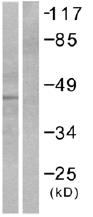 All lanes : Anti-RCC1 antibody (ab53719) at 1/500 dilutionLane 1 : Extracts from LoVo cells, minus immunising peptideLane 2 : Extracts from LoVo cells, plus immunising peptide