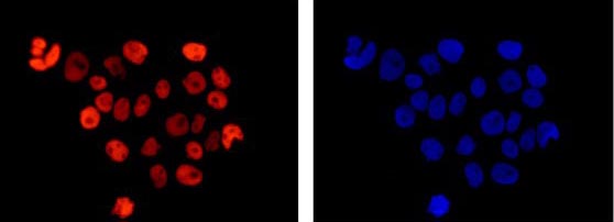 Immunofluorescent analysis of 4% paraformaldehyde-fixed A431 cells labeling RCC1 with ab181155 at 1/250 dilution followed by Goat anti rabbit IgG (Alexa Fluor® 555) secondary antibody at 1/200 diution. Counter stained with Dapi (blue).