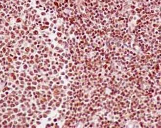 Immunohistochemical analysis of paraffin-embedded Human tonsil tissue labeling RCC1 with ab181155 at 1/100 dilution followed by prediluted HRP Polymer for Rabbit IgG. Counter stained with Hematoxylin.