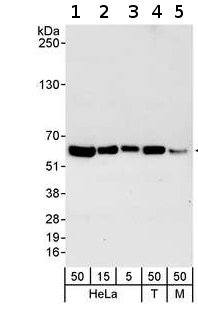 All lanes : Anti-RCC2 antibody (ab70788) at 0.04 µg/mlLane 1 : HeLa whole cell lysate at 50 µgLane 2 : HeLa whole cell lysate at 15 µgLane 3 : HeLa whole cell lysate at 5 µgLane 4 : 293T whole cell lysate at 50 µgLane 5 : NIH3T3 whole cell lysate at 50 µg