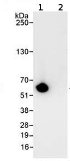 HeLa whole cell lysate (1 mg for IP, 20% of IP loaded) with ab70788 used for WB at 0.1 µg/ml. RCC2 was immunoprecipitated using ab70787, which recognizes an upstream epitope. Detection: Chemiluminescence with an exposure time of 1 second.