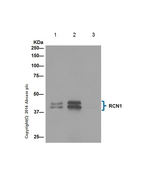 RCN1 was immunoprecipitated from 1mg of HeLa (Human epithelial cells from cervix adenocarcinoma) whole cell extract with ab198996 at 1/100. Western blot was performed from the immunoprecipitate using ab198996 at 1/1000. Anti-Rabbit IgG (HRP), specific to the non-reduced form of IgG, was used as secondary antibody at 1/1500.Lane 1: HeLa (Human epithelial cells from cervix adenocarcinoma) whole cell extract. 10ug (Input.Lane 2: HeLa whole cell extract.Lane 3: Rabbit monoclonal IgG (ab172730) instead of ab198996 in HeLa whole cell extract.The expression profile observed is consistent with what has been described in the literature PMID: 8416973. Blocking and dilution buffer and concentration: 5% NFDM/TBST.