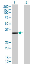 All lanes : Anti-RDH12 antibody (ab72874) at 1/500 dilutionLane 1 : RDH12 transfected 293T cell lysateLane 2 : Non transfected 293T cell lysateLysates/proteins at 25 µg per lane.SecondaryGoat Anti-Mouse IgG (H&L)-HRP at 1/2500 dilution