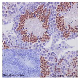 Immunohistochemical analysis of paraffin-embedded Mouse testis tissue labeling REC8 with ab192241 at 1/100 dilution followed by pre-diluted HRP Polymer for Rabbit/Mouse IgG secondary antibody and counter-stained with Hematoxylin. (inset: negative control).