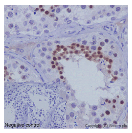 Immunohistochemical analysis of paraffin-embedded Human testis tissue labeling REC8 with ab192241 at 1/100 dilution followed by pre-diluted HRP Polymer for Rabbit/Mouse IgG secondary antibody and counter-stained with Hematoxylin. (inset: negative control).