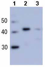 All lanes : Anti-RecA antibody (ab63797) at 1/3000 dilutionLane 1 : Molecular weight markersLane 2 : Purified RecALane 3 : Extract of E.coli AB1157