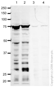 All lanes : Anti-RECQ1 antibody (ab22830) at 1 µg/mlLane 1 : HeLa (Human epithelial carcinoma cell line) Whole Cell Lysate at 20 ugLane 2 : HeLa (Human epithelial carcinoma cell line) Nuclear Lysate at 20 ug Lane 3 : HeLa (Human epithelial carcinoma cell line) Whole Cell Lysate at 20 ug with Human RECQ1 peptide (ab25318) at 1 µg/mlLane 4 : HeLa (Human epithelial carcinoma cell line) Nuclear Lysate at 20 ug with Human RECQ1 peptide (ab25318) at 1 µg/mlSecondaryGoat polyclonal to Rabbit IgG (Alexa Fluor® 680) at 1/10000 dilutionPerformed under reducing conditions.