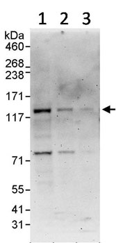 All lanes : Anti-RECQL5 antibody (ab91422) at 0.1 µg/mlLane 1 : HeLa cell lysate at 50 µgLane 2 : HeLa cell lysate at 15 µgLane 3 : HeLa cell lysate at 5 µg