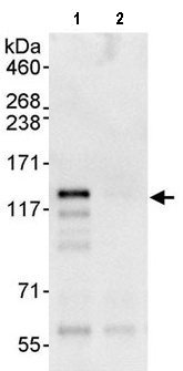 SSA1 was immunoprecipitated from 1mg HeLa whole cell lysate using 10µg ab91422. 20% of the immunoprecipitate was loaded per lane, and probed with ab91422 at 1µg/ml (lane 1) or a control IgG (lane2). Detection: chemoluminescence with an exposure time of 10 seconds.