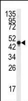 Anti-NSE antibody (ab76682) at 1/50 dilution + Y79 cell line lysates at 35 µg