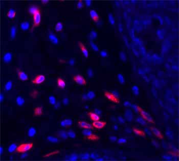 ab39626 at 4 ng/ml staining murine cecum tissue (with positive cells infiltrating the Lamina Propia of a Trichuris muris infected mouse) by IHC-P. The primary antibody was incubated overnight at 4˚C and the secondary antibody was a cyanine-3 conjugated Donkey anti-Rabbit IgG.  Heat induced antigen retrieval with a 100mM Citric Acid was used.