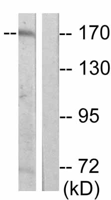 All lanes : Anti-Ret (phospho Y1062) antibody (ab51103) at 1/500 dilutionLane 1 : K562 cell lysate.Lane 2 : K562 cell Lysate. For this panel, ab51103 was pre-incubated with immunizing peptide. 