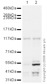 All lanes : Anti-Ret antibody (ab49596) at 1 µg/mlLane 1 : LoVo (Human colon adenocarcinoma cell line) Nuclear Lysate (ab14859)Lane 2 : K562 (Human erythromyeloblastoid leukemia cell line) Whole Cell Lysate - tumor cell line (ab29306)Lysates/proteins at 10 µg per lane.SecondaryGoat polyclonal to Rabbit IgG - H&L - Pre-Adsorbed (HRP) at 1/3000 dilutionPerformed under reducing conditions.
