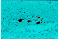 ab1840 - immunohistochemistry