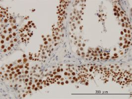 Retinoblastoma binding protein 6 antibody (ab55787) used in immunohistochemistry at 3ug/ml on formalin fixed and paraffin embedded human testis.