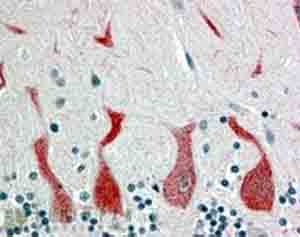 ab28767 at 4µg/ml staining Retinoic Acid Receptor alpha in human cerebellum tissue. Steamed antigen retrieval using citrate buffer pH6 was performed. AP staining. Image shows staining of Purkinje cytoplasm.