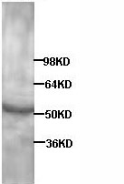 Anti-Retinoic Acid Receptor alpha antibody (ab85058) at 1/500 dilution + Human fetal brain lysate