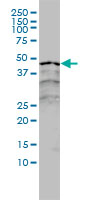 Anti-Retinoic Acid Receptor alpha antibody [2C9-1F8] (ab117728) + A431 cell lysate