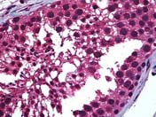 ab117728, at 5 µg/ml, staining Retinoic Acid Receptor alpha in Formalin-fixed, Paraffin-embedded Human Testis tissue by Immunohistochemistry.