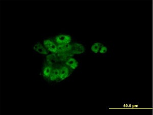ab117728 at 10µg/ml dilution staining Retinoic Acid Receptor alpha in A431 cells by Immunofluorescence.