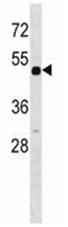 Anti-Retinoic Acid Receptor beta 2 antibody (ab130596) at 1/100 dilution + Mouse heart tissue lysates at 35 µg