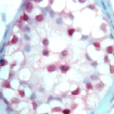 ab15515 staining Reinoic Acid Receptor beta at 1/100 dilution in human testis by Immunohistochemistry (FFPE-sections).