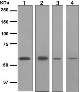 All lanes : Anti-Retinoic Acid Receptor beta antibody [EPR2017] (ab124701) at 1/1000 dilutionLane 1 : MCF7 cell lysatesLane 2 : MDA-MB-435 cell lysatesLane 3 : Daudi cell lysatesLane 4 : U-87 MG cell lysatesLysates/proteins at 10 µg per lane.SecondaryLane 1 : Goat anti-Rabbit HRP at 1/20000 dilutionLanes 2 - 4 : Goat anti-Rabbit HRP at 1/2000 dilution