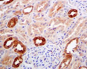 ab124701 at 1/100 dilution staining Retinoic Acid Receptor beta in paraffin-embedded Human kidney tissue by Immunohistochemistry.