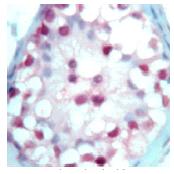 ab15516 staining Retinoic Acid Receptor Beta in human testis by Immunohistology (formalin/paraffin).