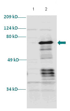 All lanes : Anti-Retinoid X Receptor alpha antibody (ab86027) at 1/1000 dilutionLane 1 : An un-induced culture of E. coliLane 2 : An induced culture of E. coliLysates/proteins at 1/5000 dilution per lane.SecondaryAnti-Rabbit IgG HRP at 1/1000 dilution