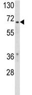 Anti-Retinoid X Receptor beta antibody (ab103027) at 1/100 dilution + MDA-MB231 cell lysate at 35 µg