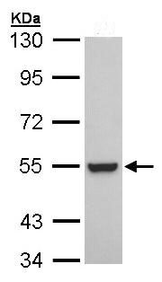 Anti-Retinoid X Receptor beta antibody (ab96824) at 1/1000 dilution + A431 whole cell lysate at 30 µg