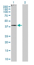 All lanes : Anti-Retinoid X Receptor gamma antibody (ab103633) at 1/500 dilutionLane 1 : Retinoid X Receptor gamma transfected 293T cell line lysateLane 2 : Non-transfected 293T cell line lysateLysates/proteins at 25 µg per lane.