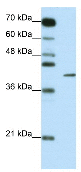 Anti-Rex1 antibody (ab50828) at 0.25 µg/ml + Jurkat cell lysate at 10 µgSecondaryHRP conjugated anti-Rabbit IgG (1: 50,000 - 100,000)