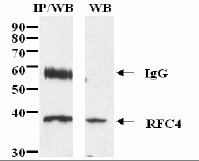 Detection of Human RFC 4 by Western Blot and Immunoprecipitation using Affinity Purified Rabbit anti-RFC 4 (ab3854).Sample: Nuclear Extract from HeLa cells.IP - 300µg; WB - 20µgAntibody: Affinity Purified anti-RFC 4 (ab3854)IP - 2µg; WB - 0.5µg/mlDetection: ECL, 10 minute exposure