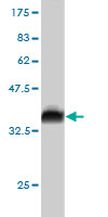 Western blot against tagged recombinant protein immunogen using ab57316 Rffl antibody at 1ug/ml.