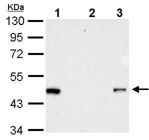 Immunoprecipitation of RFP-tagged protein. HeLa transfected lysates were subjected to immunoprecipitation using: Lane 1: 15 µg of HeLa transfected lysate Lane 2: normal rabbit IgG Lane 3: 2.5 µg ab152123 Detection ab152123 at 1/10000 dilution
